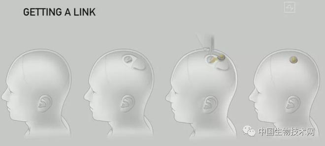 凯时k8官网，马斯克的“脑控”技术正在向试验迈进